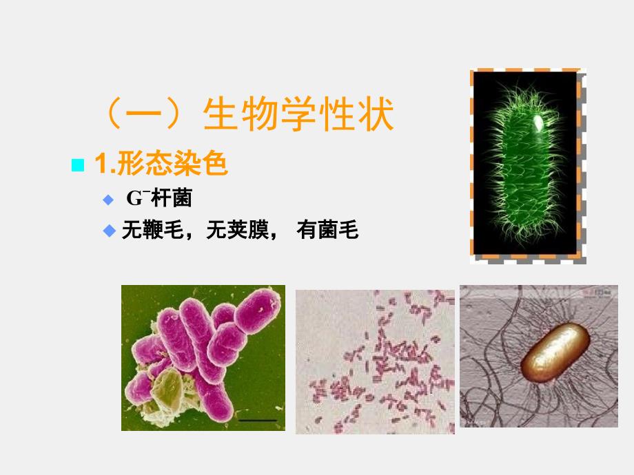 《病原生物学与免疫学》课件10章2节三、志贺菌属_第3页