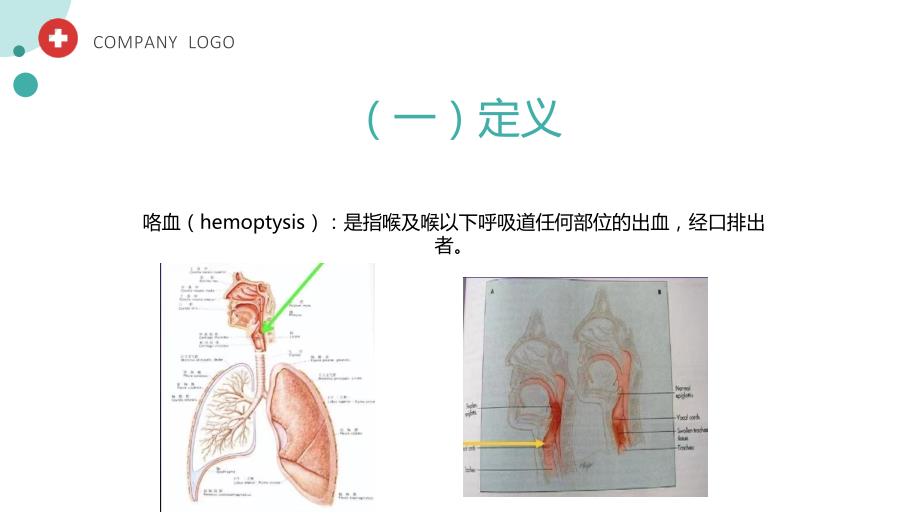 咯血患者的护理-呼吸科_第2页