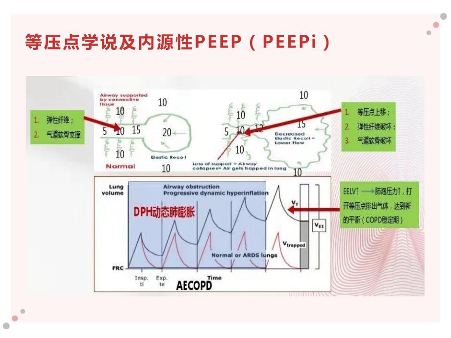 AECOPD机械通气演示文稿_第3页