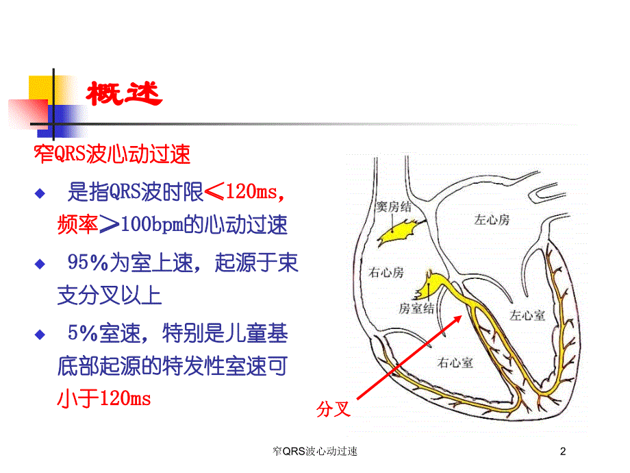 窄QRS波心动过速培训课件_第2页