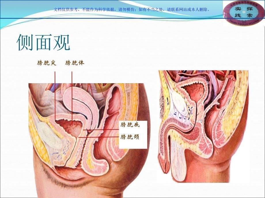 膀胱相关知识学习和探讨课件_第5页