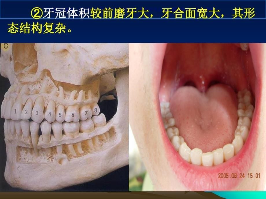 上颌磨牙解剖形态课件_第5页