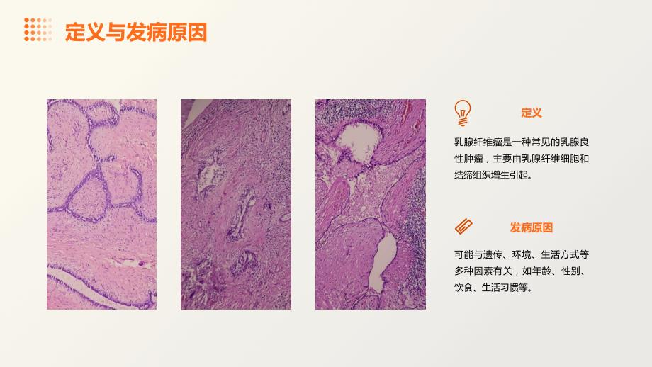 乳腺纤维瘤护理查房_第4页