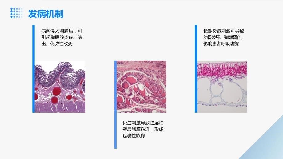 脓胸的护理课件_第5页