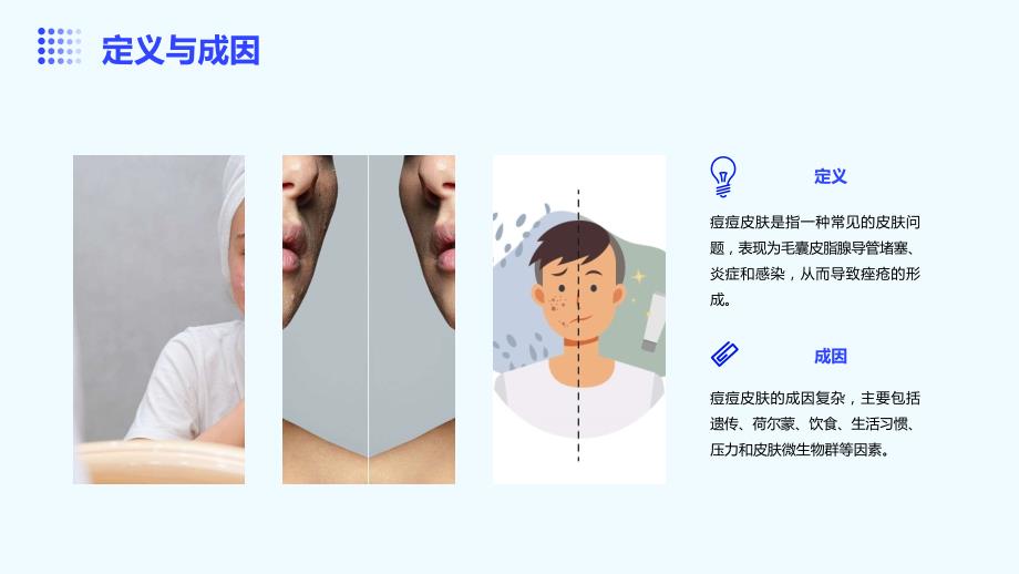 痘痘皮肤护理课件_第4页