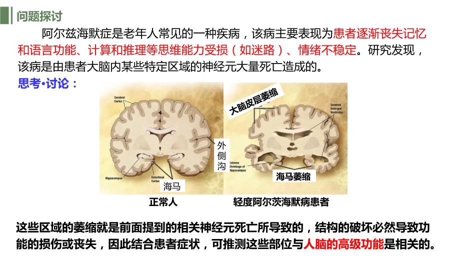 【公开课】人脑的高级功能+课件高二上学期生物人教版2019选择性必修一_第3页