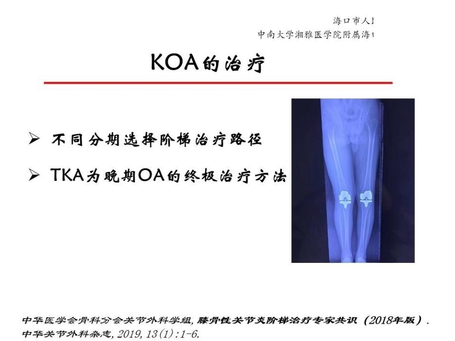 医学教材 Oxford内侧单髁置换术治疗膝骨性关节炎_第4页