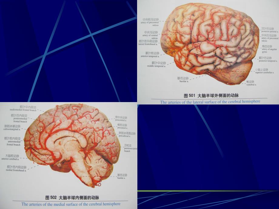 医学教程 痴呆的早期诊断和预防43x_第2页