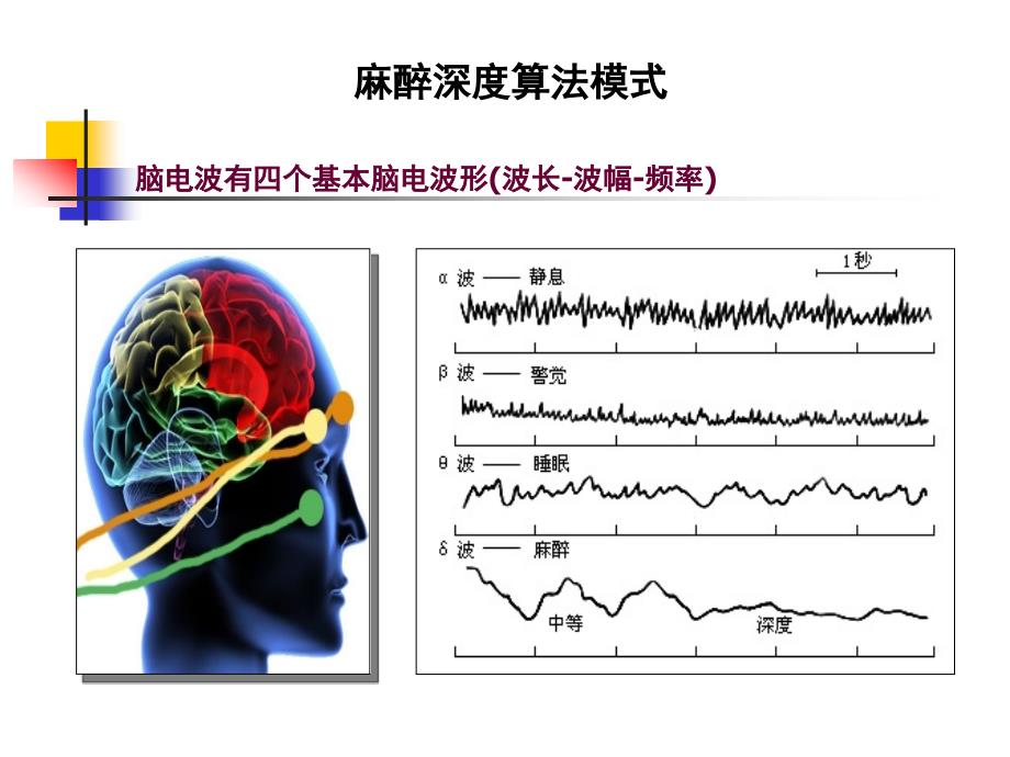 医学教程 脑电麻醉深度_第4页