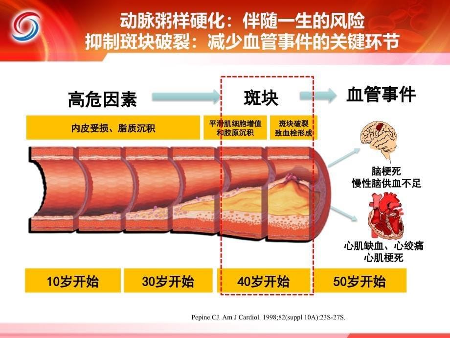 医学教程TXL动脉粥样硬化基层板块7_第5页