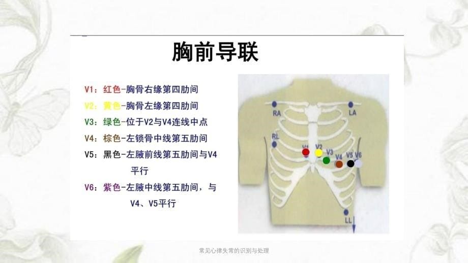 医学教程 常见心律失常的识别与处理课件_第5页