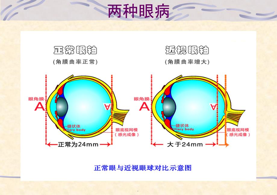 医学教程 常见传染病及其预防(用)课件_第2页