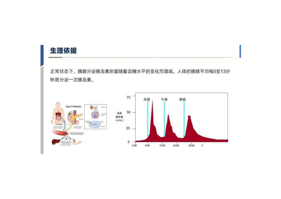 胰岛素泵的应用与护理2024课件_第4页