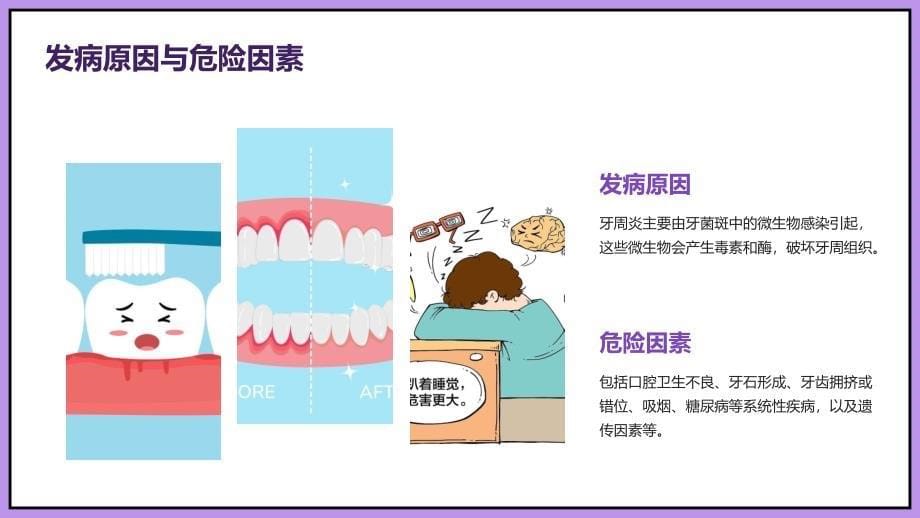 牙周炎培训课件_第5页