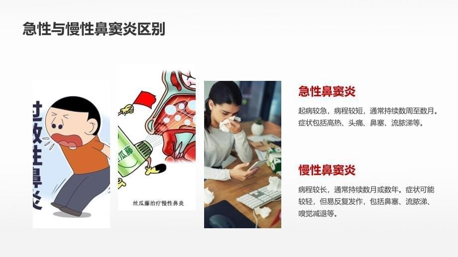 鼻窦炎培训课件_第5页