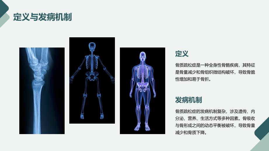 骨质疏松培训课件_第4页