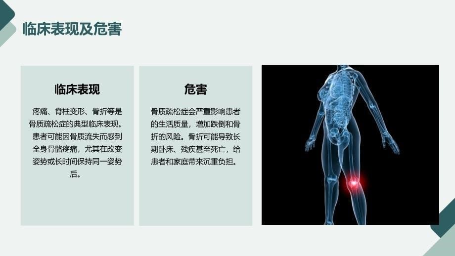 骨质疏松培训课件_第5页