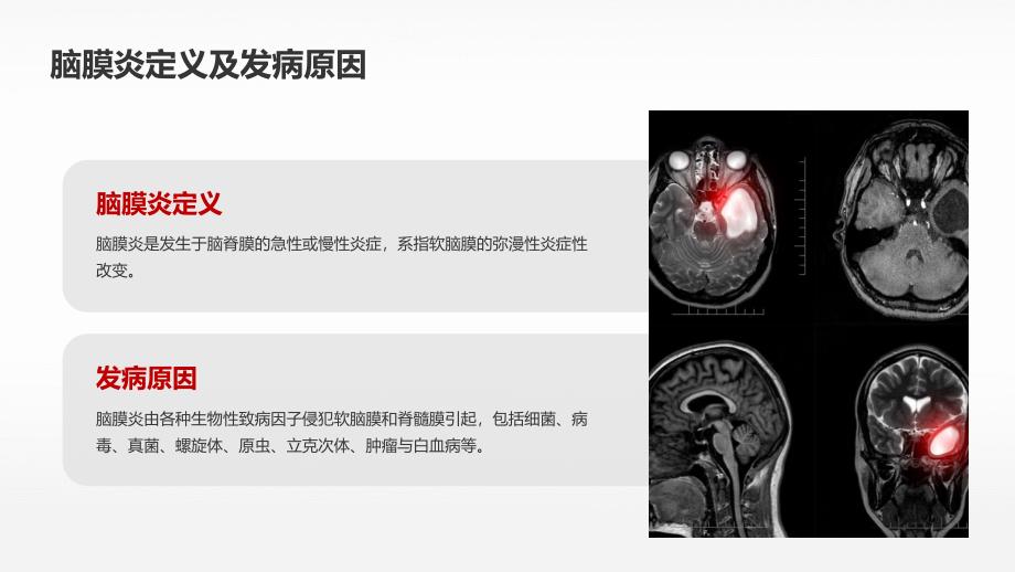 脑膜炎培训课件_第4页