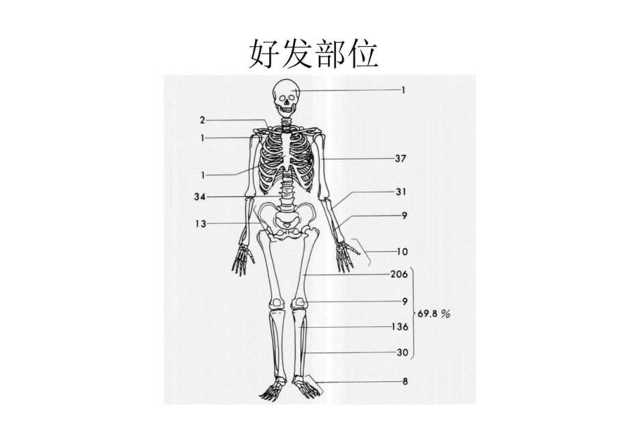 腓骨远端骨巨细胞瘤的诊疗_第4页