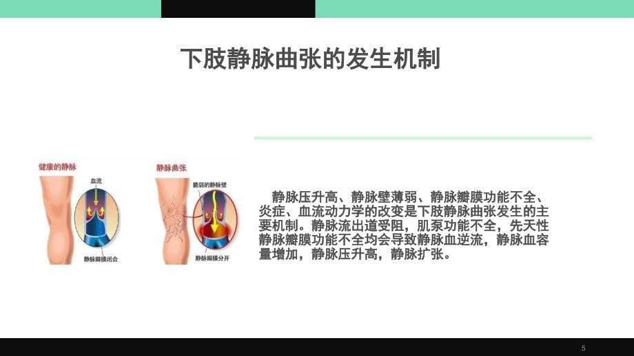 下肢静脉曲张的治疗现状和展望PPT课件_第5页