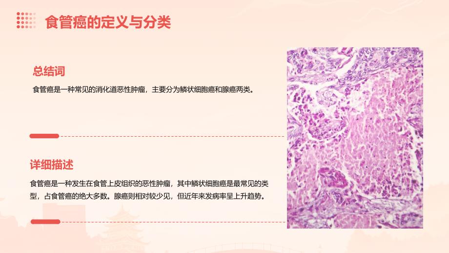 《食管癌放射治疗》课件_第4页