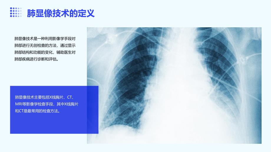 《临床医学肺显像》课件_第4页