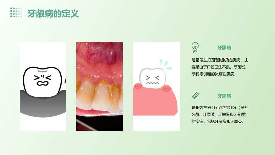 《牙龈病的表现》课件_第4页