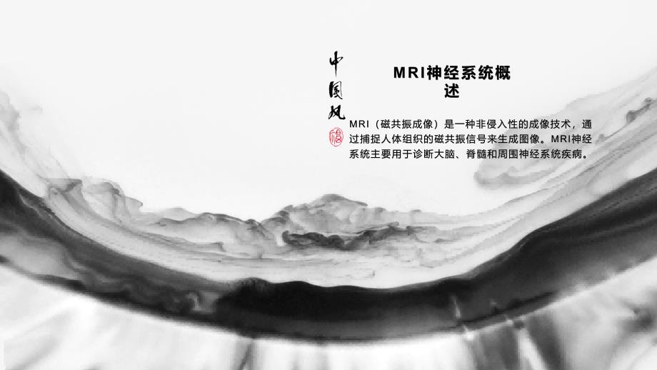 《MRI神经系统》课件_第4页