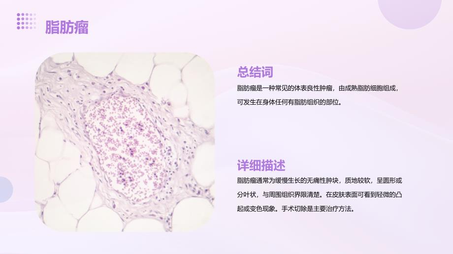 常见体表肿瘤与肿块知识培训_第4页