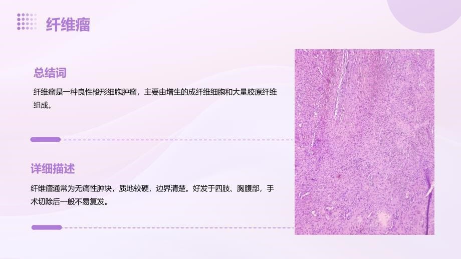 常见体表肿瘤与肿块知识培训_第5页