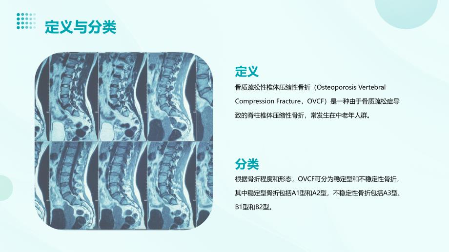 骨质疏松性椎体压缩性骨折知识课件_第4页