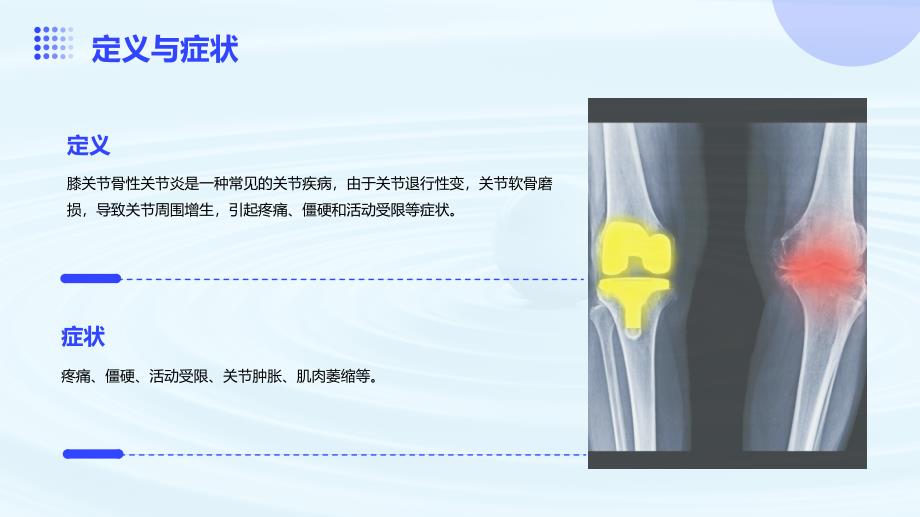 膝关节骨性关节炎的护理培训_第4页