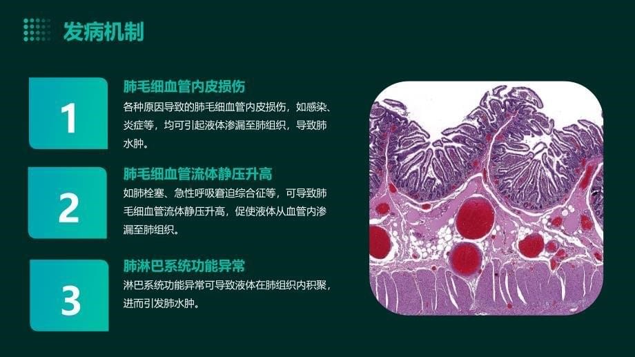 复张性肺水肿培训课件_第5页