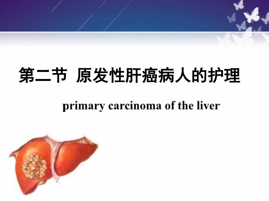 原发性肝癌的护理培训课件_第2页