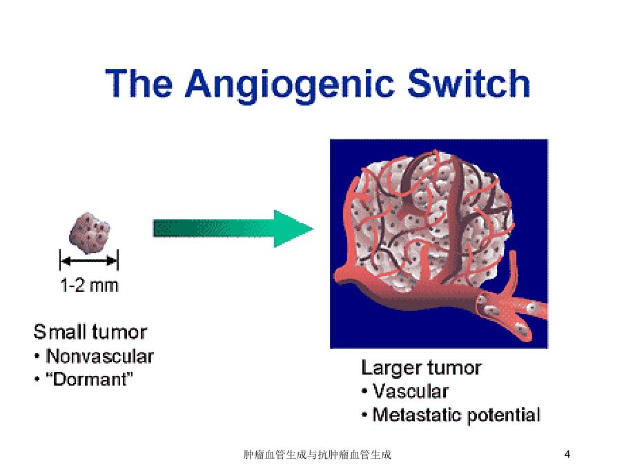 肿瘤血管生成与抗肿瘤血管生成培训课件_第4页