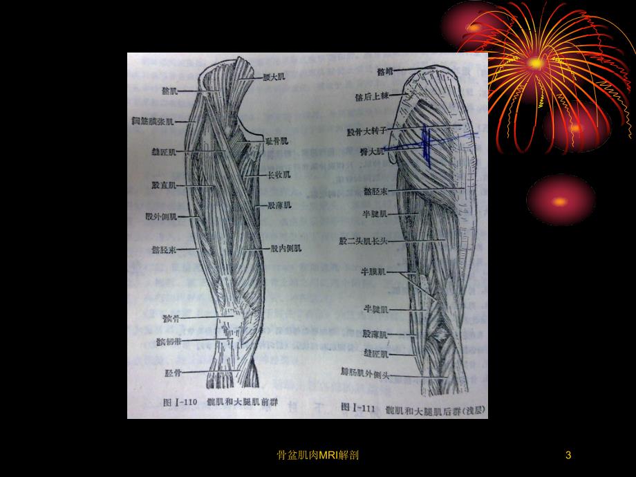 骨盆肌肉MRI解剖培训课件_第3页
