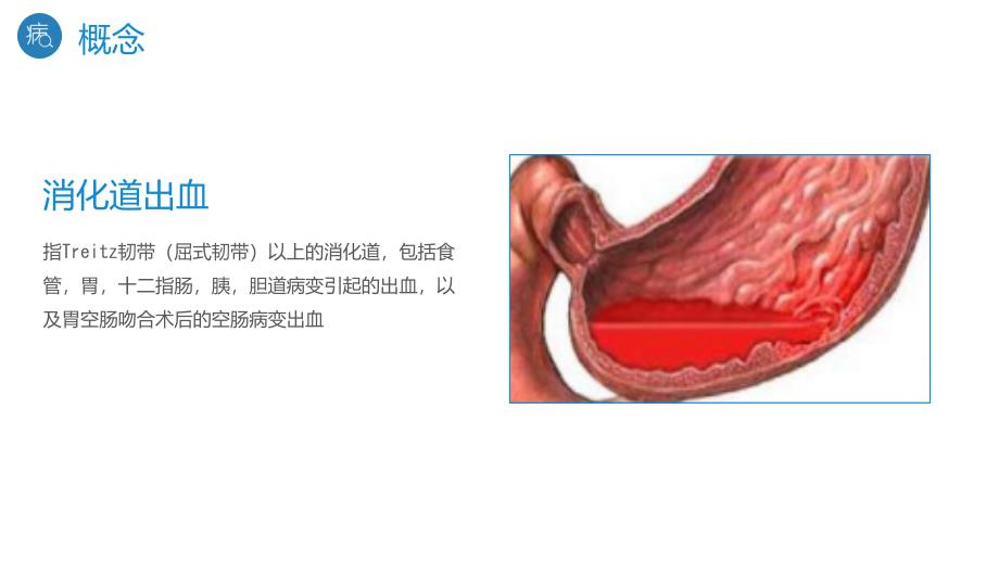 消化道出血护理(5)_第4页