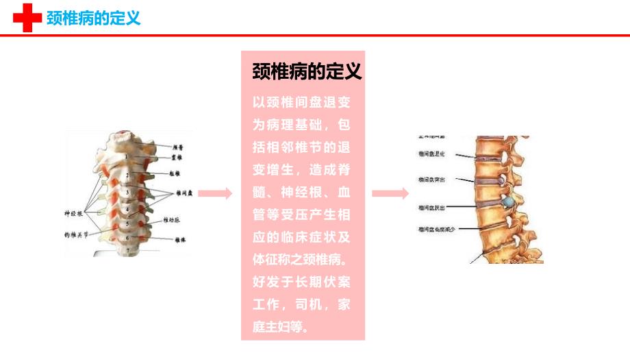 颈椎病的护理查房 (2)_第3页