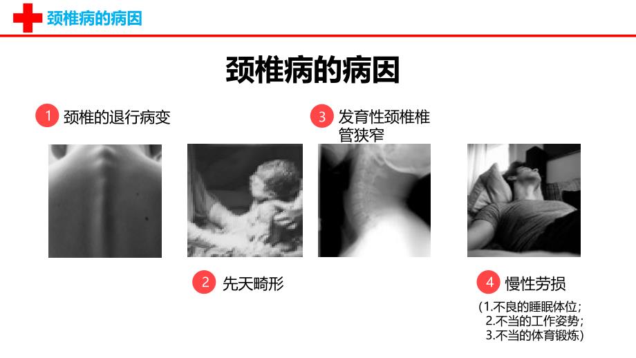 颈椎病的护理查房 (2)_第4页