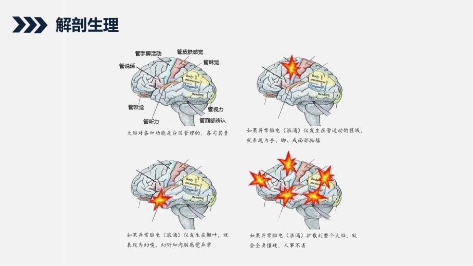 继发性癫痫患者护理查房_第5页