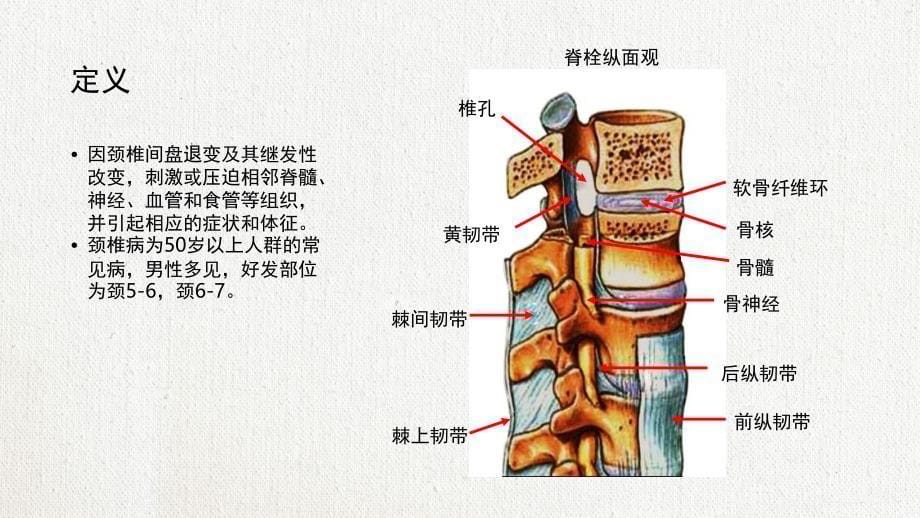 脊髓型颈椎病患者的个案护理查房(2)_第5页