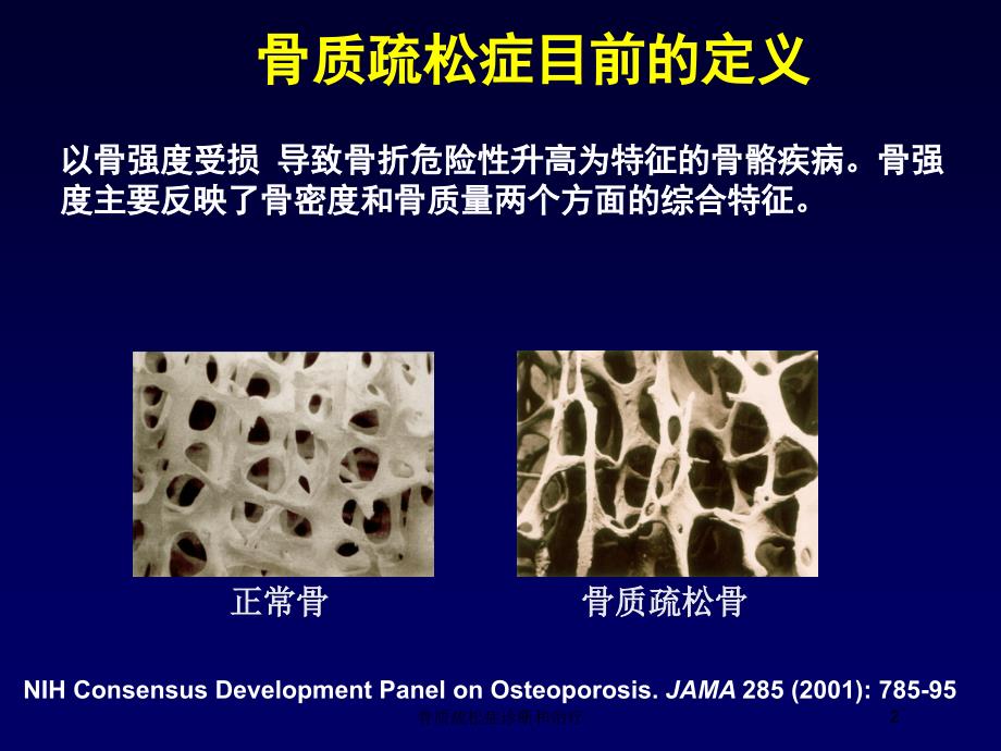 骨质疏松症诊断和治疗培训课件_第2页