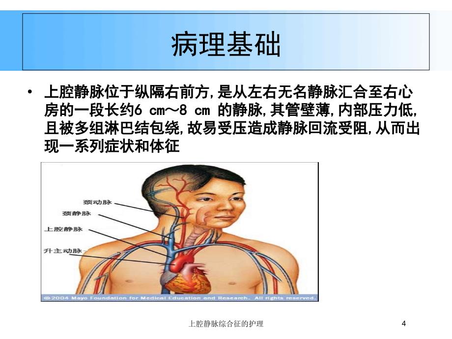 上腔静脉综合征的护理培训课件 - 副本_第4页