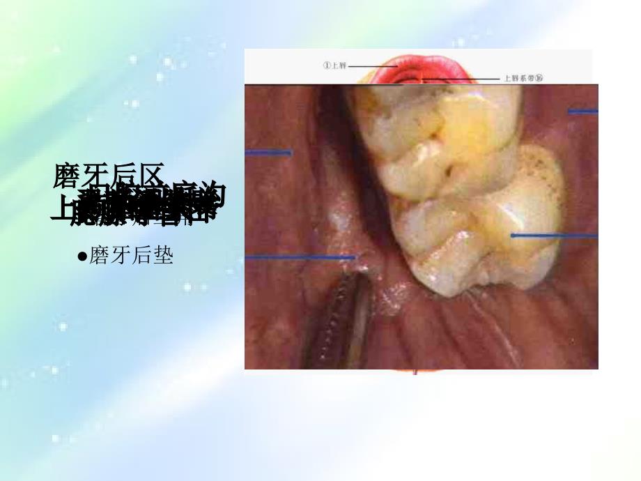 口腔局部解剖ppt_第4页