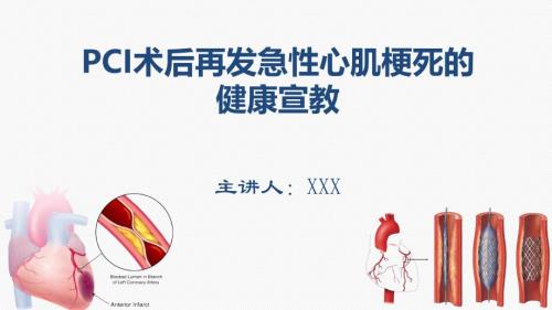 2025年医院护理课件：PCI术后再发急性心肌梗死的健康宣教